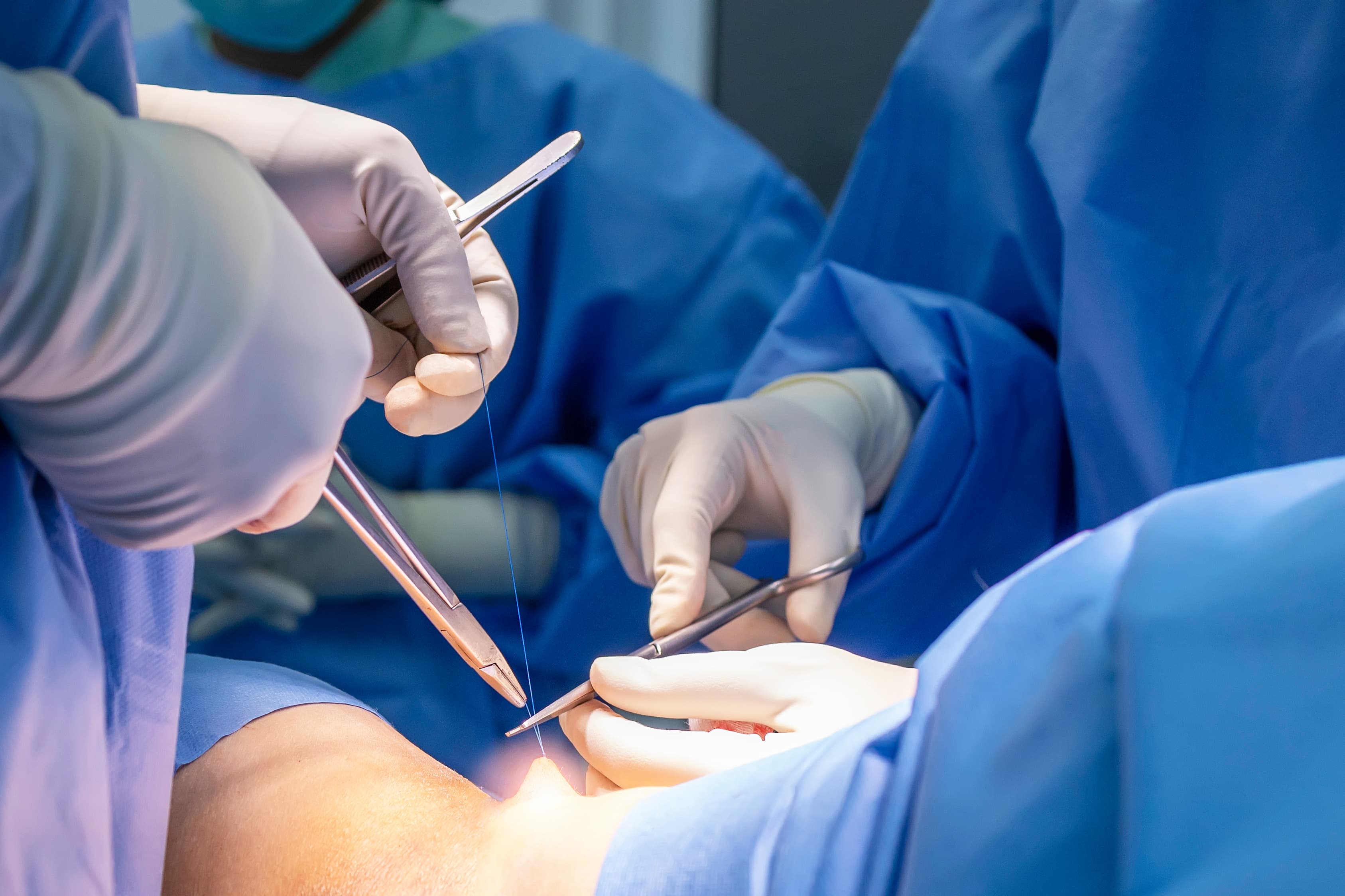 ScrubSync and Commonwealth Surgical Professionals: A Cost-Effective Solution for First Assist Coverage